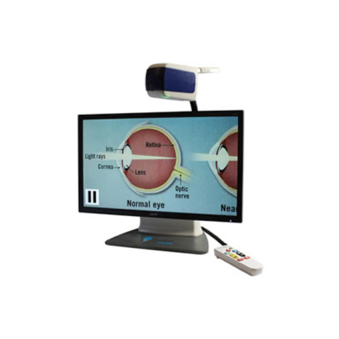 ONYX Deskset HD Video Magnifier displaying image of the eye anatomy